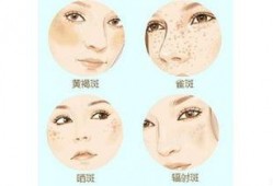 斑解最新爆料,最新爆料背后的惊人真相